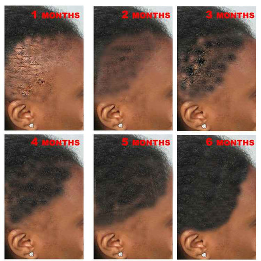 Isn't Hair Growth Suppose to be easy? - SCENICBELLE