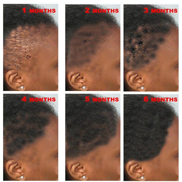Isn't Hair Growth Suppose to be easy?