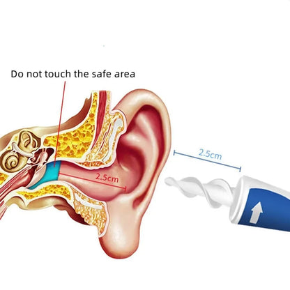 Nucomfy™ Spiral Ear Wax Remover